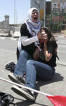 A Palestinian woman cries for help as she holds a cloth to the head wound suffered by Jewish American art student, Emily Henochowicz, who had just been shot in the face with a tear gas canister by an Israeli soldier. Associated Press photograph by Majdi Mohammed.
