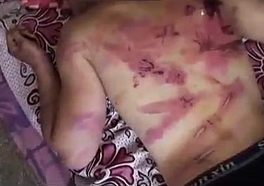 A mass of welts, cuts, and burns. Screenshot from amateur video showing Ramy Essam's back after being tortured in the Egyptian Museum by the army on March 18, 2011.